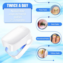 12915 nail fungus cleaning device